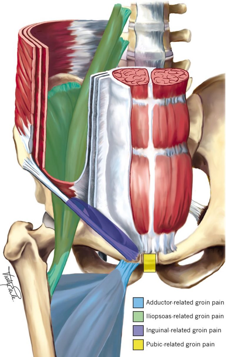 Why Is The Right Side Of My Groin Hurting Male